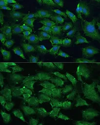 Anti-SHP2 antibody used in Immunocytochemistry/ Immunofluorescence (ICC/IF). GTX35210