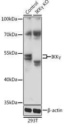 Anti-IKK gamma antibody used in Western Blot (WB). GTX35211