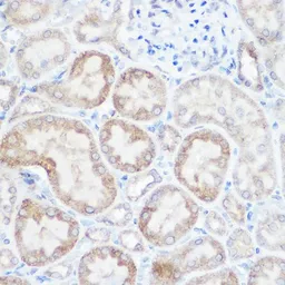 Anti-NDUFB4 antibody used in Immunocytochemistry/ Immunofluorescence (ICC/IF). GTX35219