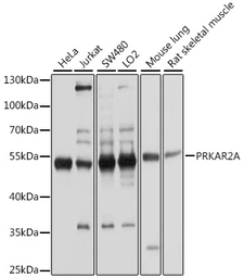 Anti-PKA R2 antibody used in Western Blot (WB). GTX35228