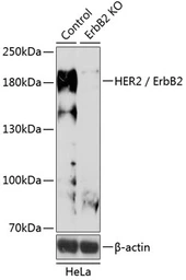 Anti-Her2 / ErbB2 antibody used in Western Blot (WB). GTX35231