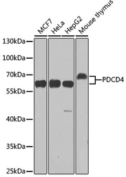 Anti-PDCD4 antibody used in Western Blot (WB). GTX35232