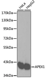 Anti-APE1 antibody used in Western Blot (WB). GTX35233