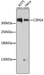 Anti-NG2 antibody used in Western Blot (WB). GTX35234