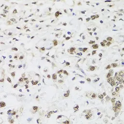 Anti-PP1C gamma antibody used in IHC (Paraffin sections) (IHC-P). GTX35235