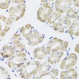 Anti-PP1C gamma antibody used in IHC (Paraffin sections) (IHC-P). GTX35235