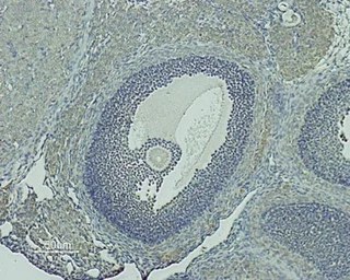 Anti-GnRHR antibody used in IHC (Paraffin sections) (IHC-P). GTX35245