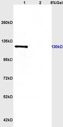 Anti-CD163 antibody used in Western Blot (WB). GTX35247