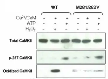 Anti-CaMKII (oxidized) antibody used in Western Blot (WB). GTX36254