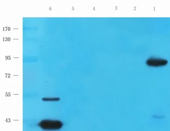 Anti-PGC1 alpha antibody used in Western Blot (WB). GTX37356