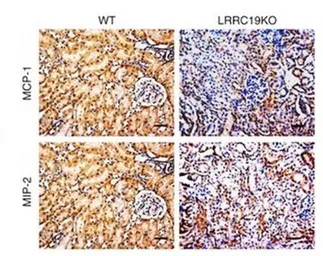 Anti-MCP1 / CCL2 antibody used in IHC (Paraffin sections) (IHC-P). GTX37379