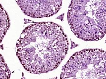 Anti-FOXJ1 antibody used in IHC (Paraffin sections) (IHC-P). GTX37424