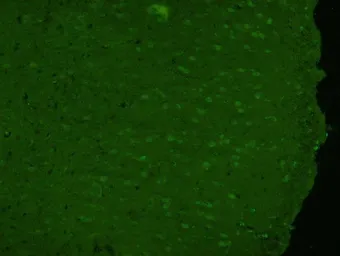 Anti-FOXJ1 antibody used in IHC (Paraffin sections) (IHC-P). GTX37424