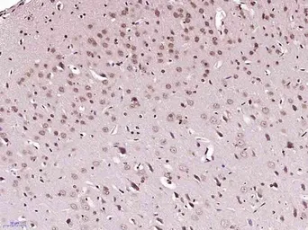 Anti-FOXJ1 antibody used in IHC (Paraffin sections) (IHC-P). GTX37424