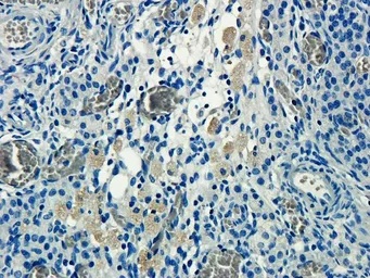 Anti-CD155 antibody used in IHC (Paraffin sections) (IHC-P). GTX37437