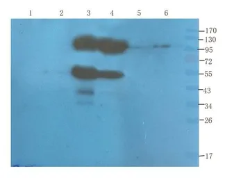 Anti-CD155 antibody used in Western Blot (WB). GTX37437