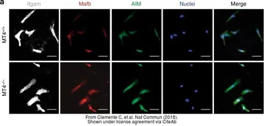 Anti-CD5L antibody used in Immunocytochemistry/ Immunofluorescence (ICC/IF). GTX37448
