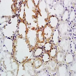 Anti-CD30 antibody used in IHC (Paraffin sections) (IHC-P). GTX37452