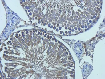 Anti-TGF beta Receptor 2 antibody used in IHC (Paraffin sections) (IHC-P). GTX37527