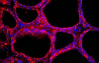 Anti-NIS antibody used in IHC (Frozen sections) (IHC-Fr). GTX37599
