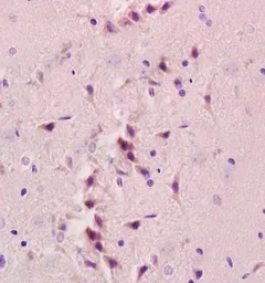 Anti-NIS antibody used in IHC (Paraffin sections) (IHC-P). GTX37599