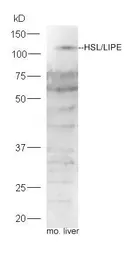 Anti-HSL antibody used in Western Blot (WB). GTX37663