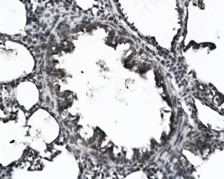 Anti-KGF antibody used in IHC (Paraffin sections) (IHC-P). GTX37698