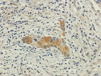 Anti-EPO receptor antibody used in IHC (Paraffin sections) (IHC-P). GTX37704