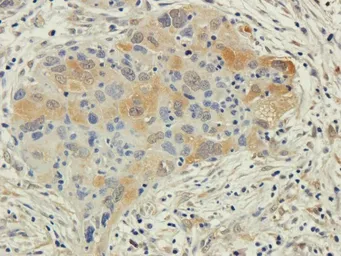 Anti-EPO receptor antibody used in IHC (Paraffin sections) (IHC-P). GTX37704