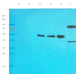 Anti-EPO receptor antibody used in Western Blot (WB). GTX37704
