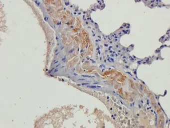 Anti-beta 2 Defensin antibody used in IHC (Paraffin sections) (IHC-P). GTX37717