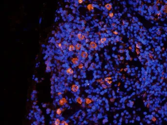 Anti-Beclin 1 antibody used in IHC (Frozen sections) (IHC-Fr). GTX37770