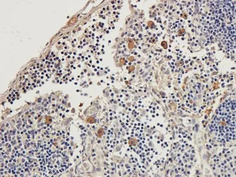 Anti-Beclin 1 antibody used in IHC (Paraffin sections) (IHC-P). GTX37770