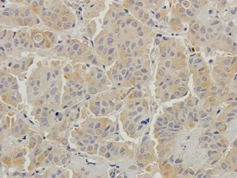 Anti-Beclin 1 antibody used in IHC (Paraffin sections) (IHC-P). GTX37770