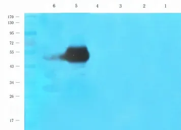 Anti-Beclin 1 antibody used in Western Blot (WB). GTX37770