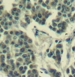 Anti-Her3 / ErbB3 (phospho Tyr1328) antibody used in IHC (Paraffin sections) (IHC-P). GTX38571