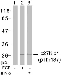 Anti-p27 Kip1 (phospho Thr187) antibody used in Western Blot (WB). GTX38594