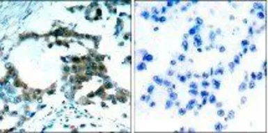 Anti-PKC theta (phospho Ser695) antibody used in IHC (Paraffin sections) (IHC-P). GTX38611