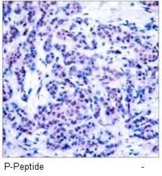 Anti-JunD (phospho Ser255) antibody used in IHC (Paraffin sections) (IHC-P). GTX38656