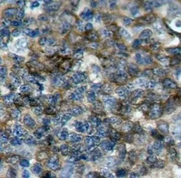 Anti-VASP (phospho Ser157) antibody used in IHC (Paraffin sections) (IHC-P). GTX38672