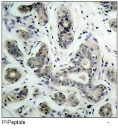 Anti-Bad (phospho Ser136) antibody used in IHC (Paraffin sections) (IHC-P). GTX38680