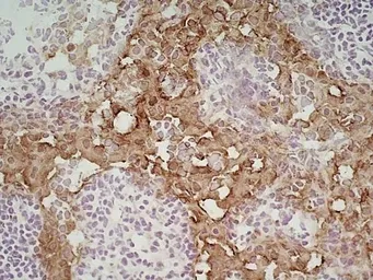Anti-Marco antibody [ED31] used in IHC (Frozen sections) (IHC-Fr). GTX39743