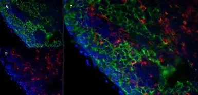 Anti-Marco antibody [ED31] used in IHC (Frozen sections) (IHC-Fr). GTX39744