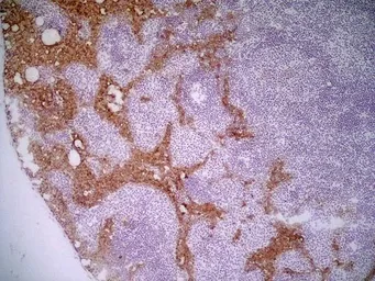 Anti-Marco antibody [ED31] used in IHC (Frozen sections) (IHC-Fr). GTX39744