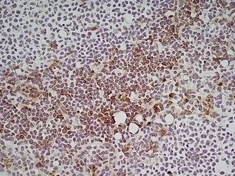 Anti-Ly6c antibody [ER-MP20] used in IHC (Frozen sections) (IHC-Fr). GTX39790