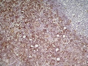 Anti-Ly6c antibody [ER-MP20] used in IHC (Frozen sections) (IHC-Fr). GTX39790