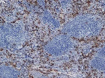 Anti-Ly-6B.2 antibody [7/4] used in IHC (Frozen sections) (IHC-Fr). GTX39794