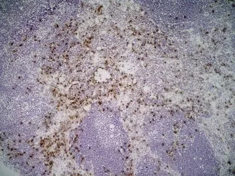 Anti-Ly-6B.2 antibody [7/4] used in IHC (Frozen sections) (IHC-Fr). GTX39794