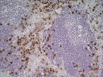 Anti-Ly-6B.2 antibody [7/4] used in IHC (Frozen sections) (IHC-Fr). GTX39794