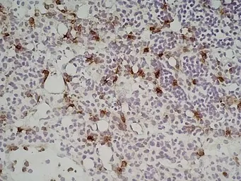 Anti-Ly-6B.2 antibody [7/4] (Low endotoxin, azide free) used in IHC (Frozen sections) (IHC-Fr). GTX39796
